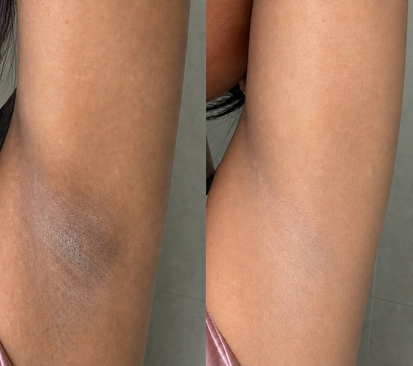 Illustrative side-by-side underarm freshness comparison before and after deodorant use
